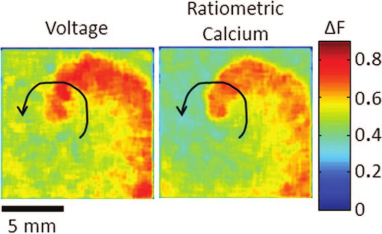 Herron et al Optical Mapping 615 Figure 4. Simultaneous optical mapping of intracellular calcium and membrane voltage in neonatal rat ventricular myocyte monolayers.