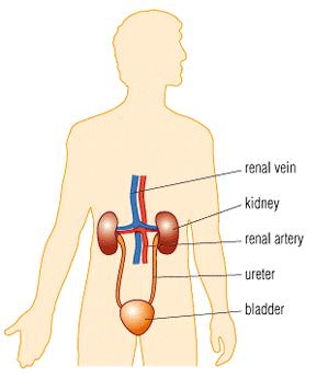 Kidney transplants (Bio only) Instead of dialysis a kidney could be transplanted into the patient.