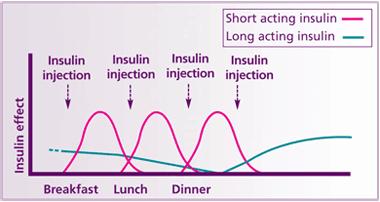 Typical Insulin Regimes Basal-Bolus 3 x rapid/short acting insulins given before mealtimes with a long acting given at night. Allows more flexibility of timing and quantity of food.