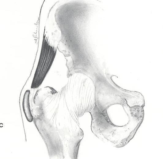 Main Bursae of the Hip