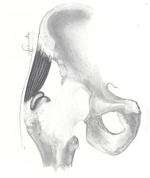 Main Bursae of the Hip