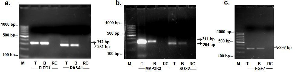 Fig. 4.7: Validation of exome sequencing data from dataset-ii by PCR. Representative gel images for validation of dataset-ii are depicted.