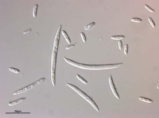 Microconidia Macroconidia Chlamydospores Fusarium oxysporum and F.