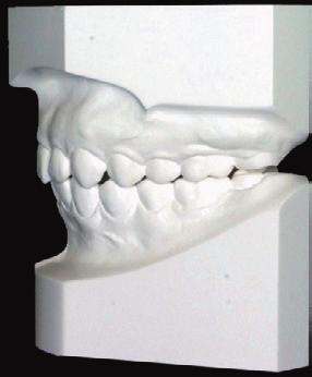 the mandibular anterior segment.