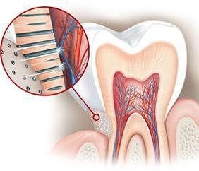 Tooth Sensitivity Tooth sensitivity also known as dentin hypersensitivity affects the tooth or exposed root surfaces This occurs when the enamel that protects the teeth gets thinner, or when gums