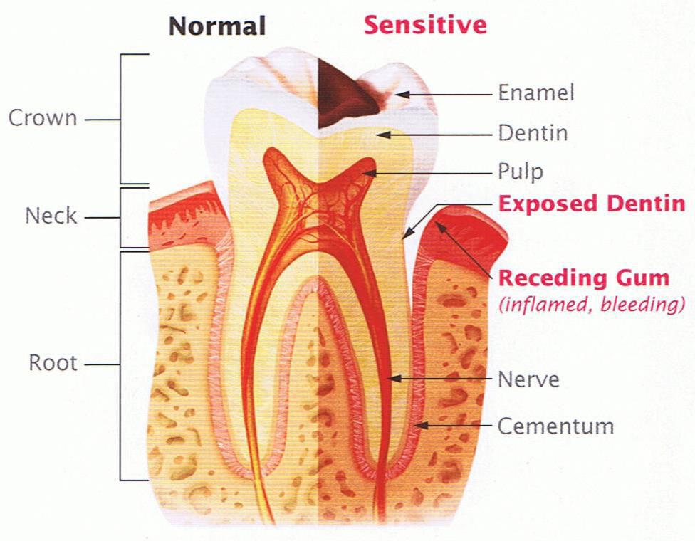 Tooth Sensitivity Causes include: Wear and tear - Over time, brushing too hard or using a hard toothbrush can wear down enamel and expose the dentin Tooth decay near the gum line Gum disease -