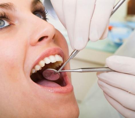 Common Oral Problems Dental Plaque Gum Diseases