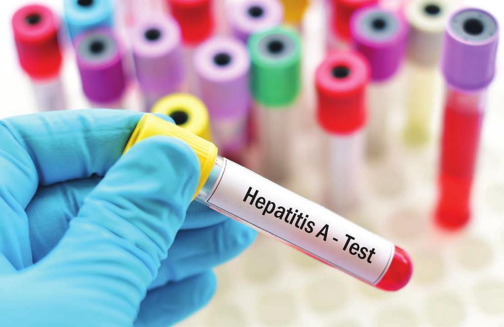 Hepatitis A outbreak increases in Michigan Health Local and state public health officials continue to investigate a large hepatitis A outbreak in Michigan. According to an Oct.