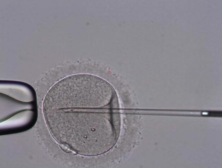 Treatment: Male Address lifestyle factors (alcohol, smoking, Se, Zn, vitamin C) Azoospermia Use donor sperm Sperm autoimmunity Intra-cytoplasmic sperm injection (ICSI) Sperm injected without tail