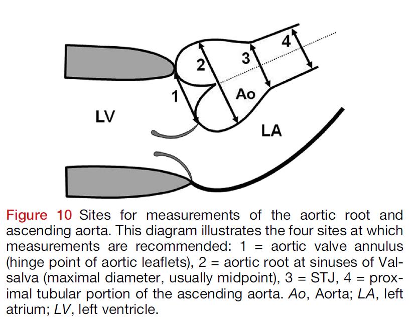 Measurements of the Aortic Root: during diastole or duringf systole?