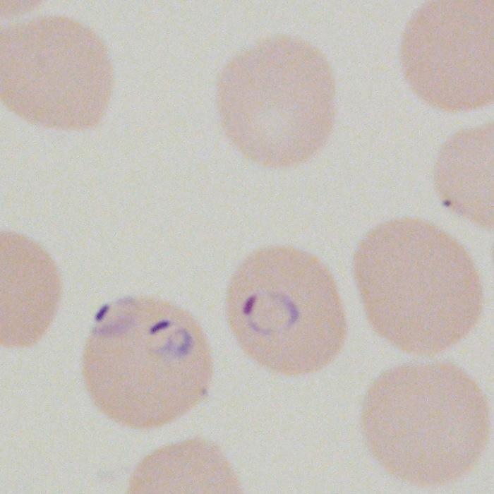 As a result the parasitemia can exceed 30%. For P. falciparum, the stage seen in peripheral blood is early trophozoites, or rings.