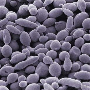 Fermentation in Microbes (Ex.