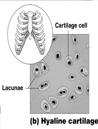 types of cartilage Hyaline cartilage Elastic cartilage Fibrocartilage Types of Connective Tissue Hyaline cartilage Most common cartilage