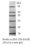 code product name application/description unit unit price old/new ` BioLit Ready-to-use Protein Molecular Weight Standards BioLit protein molecular weight standards cover the useful range of protein