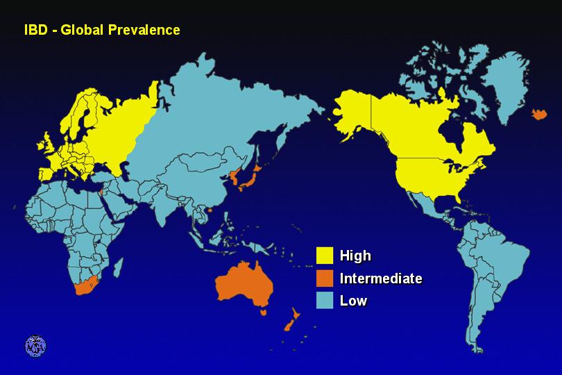 GEOGRAPHICAL PREVALENCE OF IBD How common is IBD in the United States? 25 % of IBD occurs in childhood USA Prevalence An estimated 1.