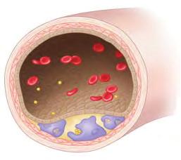 cellular elements of blood. Erythrocytes, for example, circulate for only 120 days on average before being replaced; the old cells are consumed by phagocytic cells in the liver and spleen.
