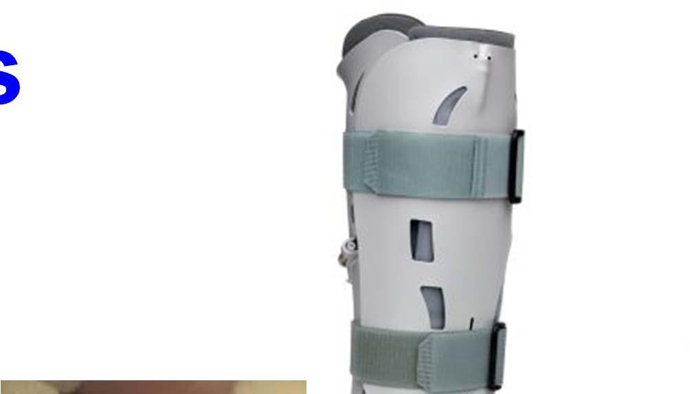Ankle fractures Nonoperative o short-leg walking cast/boot indications
