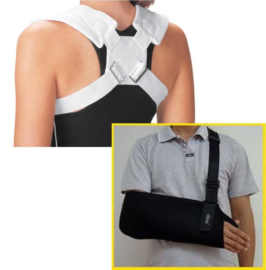 Clavicle fractures nonoperative Tx Sling Immobilization technique o sling or figure-of-eight (prospective studies have not shown difference between sling and figure-of-eight braces) o after 2-4 weeks