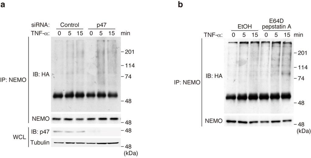 Supplementary Figure S4. Silencing of p47 and E64D/pepstatin A treatment result in the enhanced accumulation of polyubiquitinated NEMO after TNF-α stimulation.