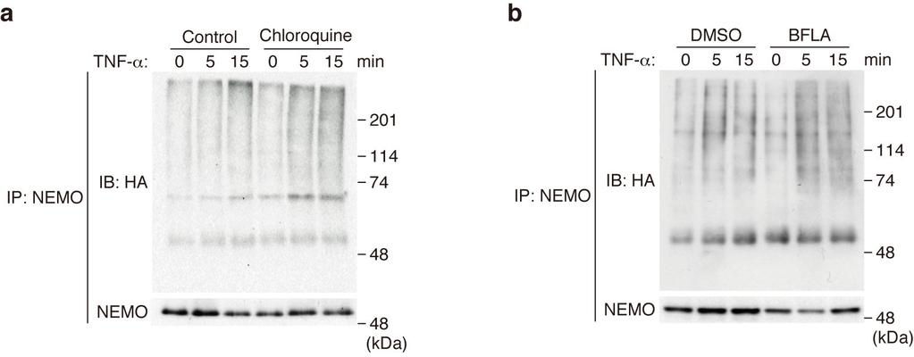 Supplementary Figure S5. Inhibition of lysosomal protein degradation by chloroquine or bafilomycin A1 results in the enhanced accumulation of polyubiquitinated NEMO after TNF-α stimulation.