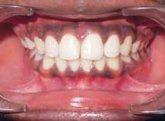(periodontopathic) and manifest the ability of enhanced
