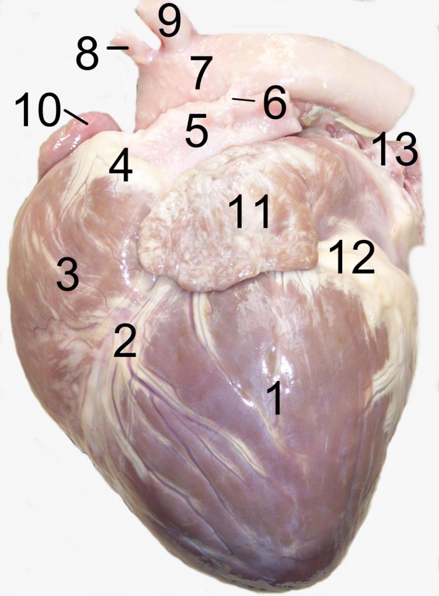 Structures of the Heart: External Anatomy Auricles - largest and most visible parts of the atria Left