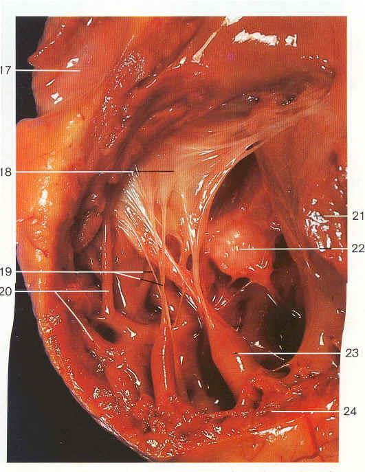 Structures of the Heart: Internal Chordae tendinae connect the free edges of the valvular flaps to the