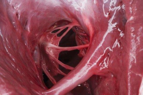 Structures of the Heart: Internal Anatomy Moderator band - tissue present in the right ventricle; originates at interventricular septum Not attached