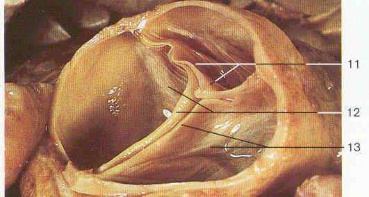 Structures of the Heart: Internal Anatomy Aortic valve and pulmonic valves - 3 flaps attached at their