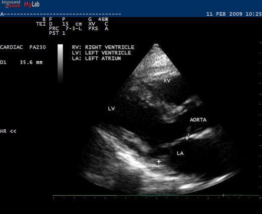 Dog heart ultrasound Can see