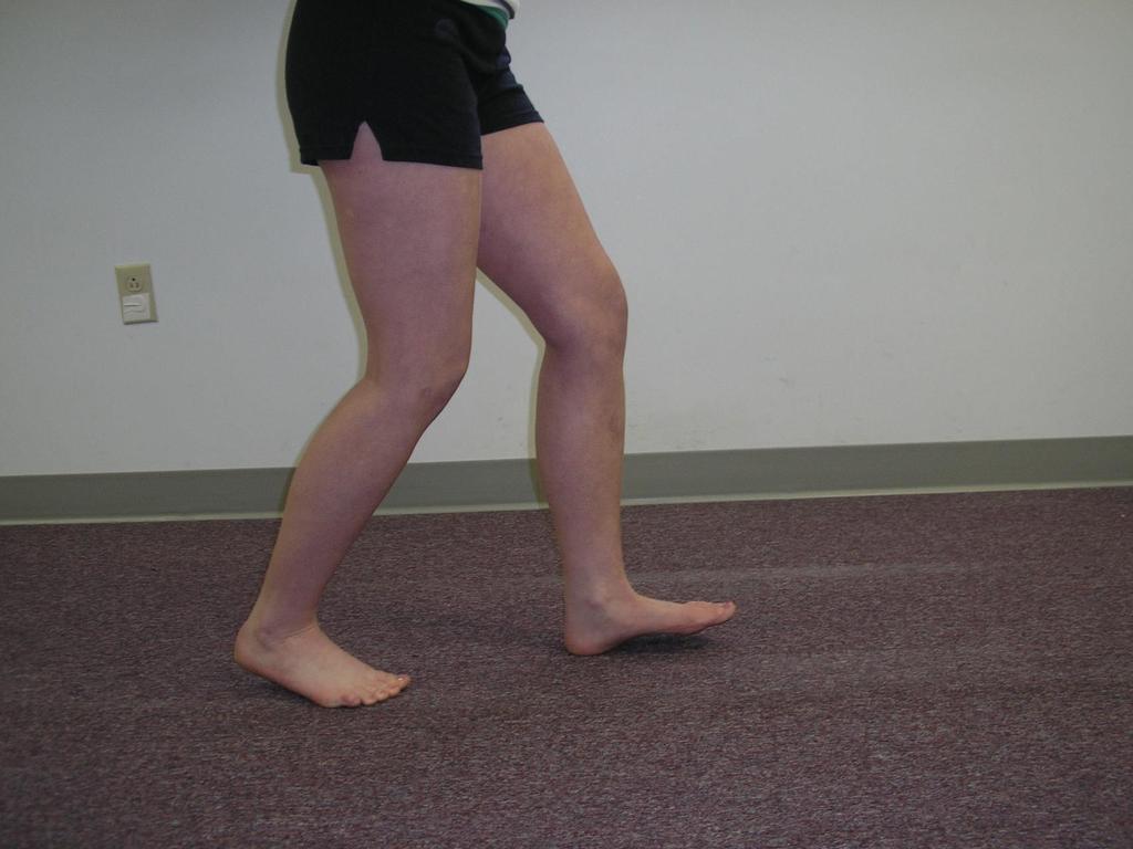 Gait Dysfunction-Knee flexion