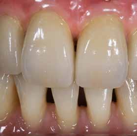 Case Report 13 2011 Oral Rehabilitation with CAMLOG implants after loss of dentition due to an accident Dr Hitoshi Minagawa Tokyo, Japan Prosthetics Dr Hitoshi Minagawa successfully completed his