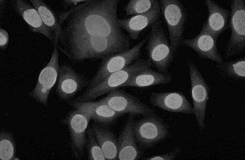 Anti-nuclear antibody patterns Homogeneous Rim GENES RISK Speckled BEHAVIOR ENVIRONMENT Smoking Sun exposure Antigen