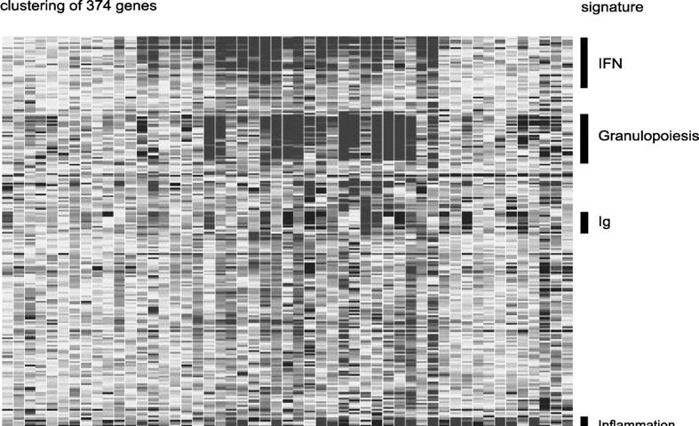 Interferon Signature Infection Bacterial EBV Somatic Mutation, Affinity Maturation and the Generation of