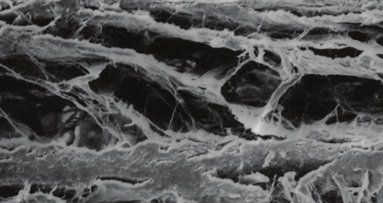 CytoPlast RTM RESORBABLE MEMBRANE TYPE I BOVINE COLLAGEN RESORBABLE TISSUE MATRIX Resorbable; eliminates second surgery Unique fiber orientation