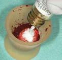 SynthoGraft must only be wetted with the patient s blood. 4.