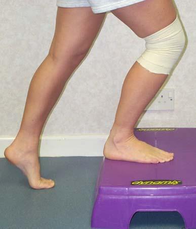 Step up leading with your operated leg followed by the other leg. Step down with the good leg first.