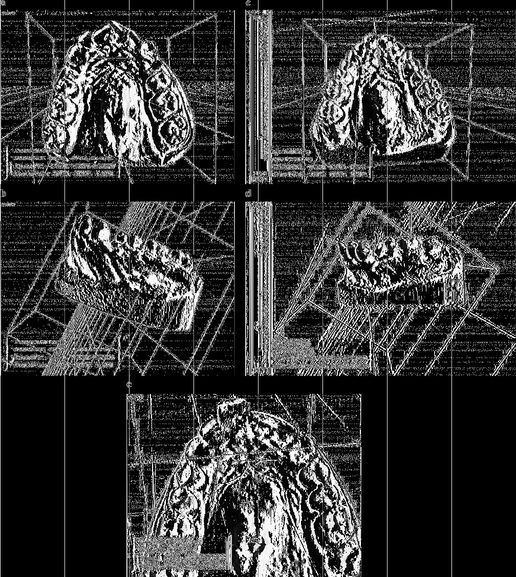 174 N. Stivaros et al. Figure 2 Upper first permanent molar mesial movement (a and b), tipping (c), and rotation (e and d). terms of prevention of mesial movement or distal tipping (P > 0.05).