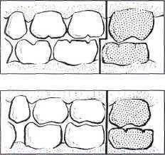 in the maxillary arch, the primate space is located between the lateral incisors and canines in the mandibular arch, the primate space is located between the canines and first molars *** Spacing is