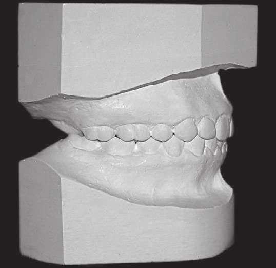 The mandibular position remained vertically unaltered, however,