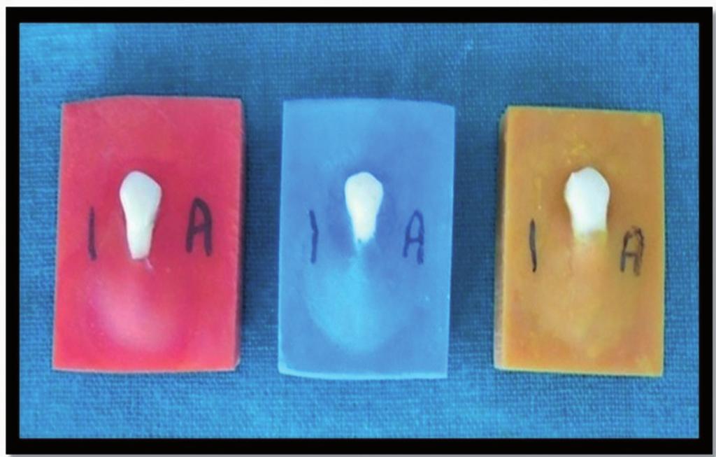 different treatment stages and to avoid contamination of the prospective bonding buccal surface.