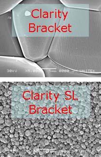 Key Ingredient: New 3M Unitek Ceramic Material Similar Polycrystalline Alumina as Clarity Brackets, Only Better!