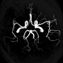 MR Angiography (MRA) Superior Cerebellar Artery Anterior Cerebral Artery Basilar Artery Middle Cerebral Artery