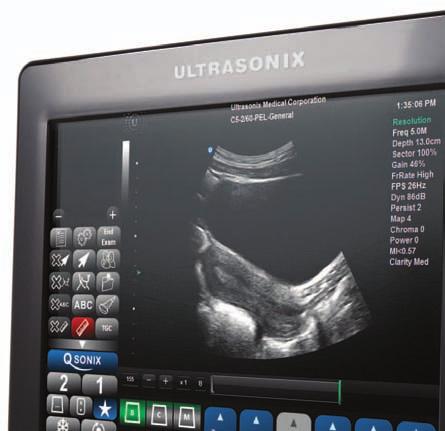 ultrasound your