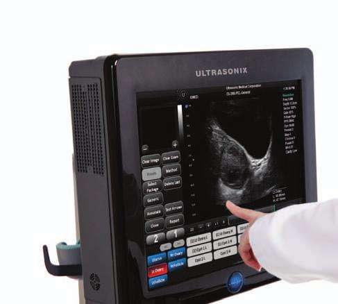 SonixTablet Save space without compromising performance SonixTablet is a compact ultrasound system with a 19 touch screen that can be mounted from the ceiling or wall to preserve floor space.