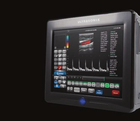 With SonixGPS Guidance Positioning System, targeting is easy Our SonixGPS ultrasound guidance helps clearly predict and see the needle s trajectory during invasive procedures.