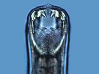 2. Hookworm Human hookworm (Necator sp.