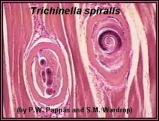 4. Trichinella From eating undercooked pork Causes