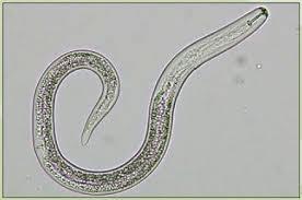 Unlike flatworms, the roundworms have a complete digestive tract with two separate openings, a mouth and an anus.