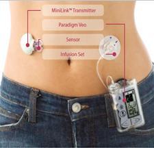 MONITORING INSULIN PUMP THERAPY REAL
